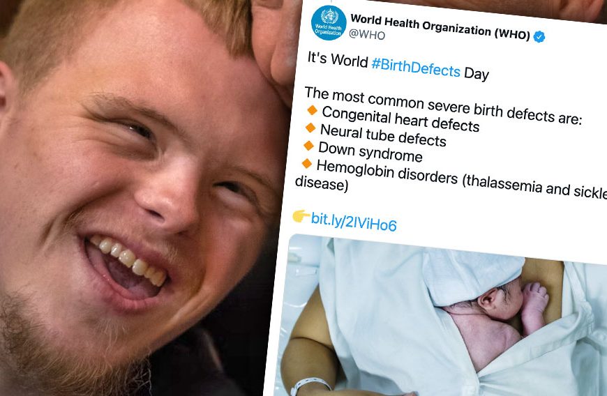 World Health Organisation Reclassifies Down Syndrome as a Birth Defect Akin to a Disease
